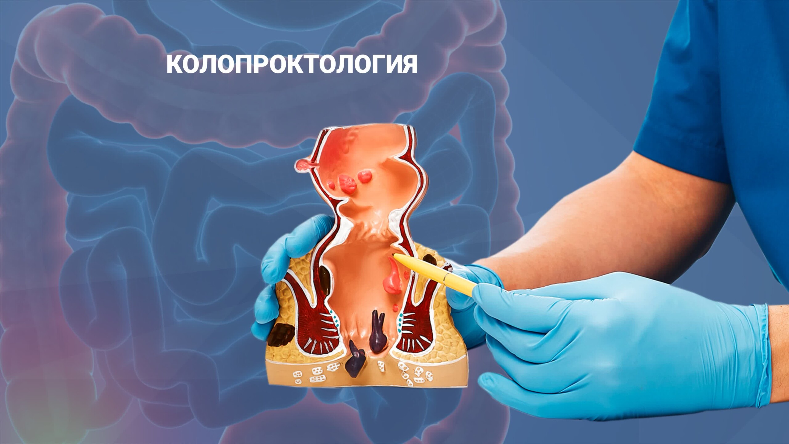 Колопроктология